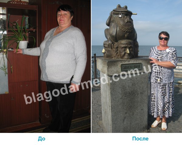  г. Стаханов - Светлана Семеновна, 62 года